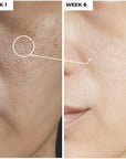 5% Niacinamide Serum + 1% Hyaluronic acidDermabay