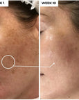 Brightening Serum with Kojic Acid