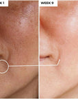 Dermabay Vitamin C 15% + Hyaluronic Acid 1% Serum