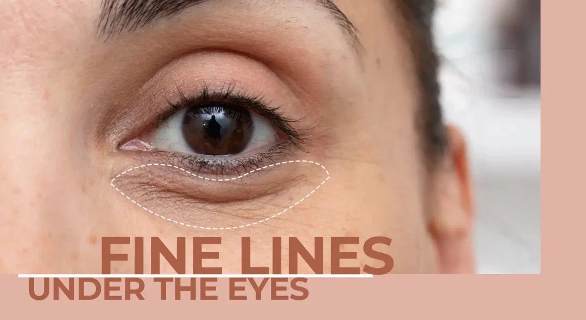 Fine Lines Under the Eyes: Why They Appear Earlier Than You Think - Dermabay