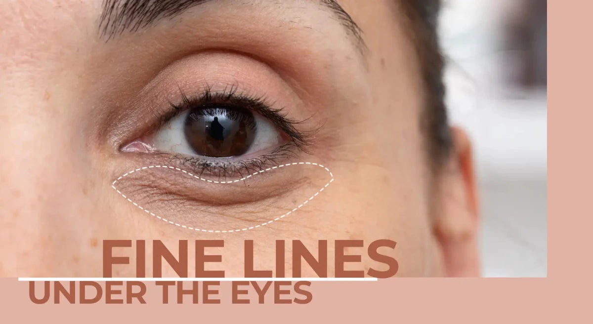 Fine Lines Under the Eyes: Why They Appear Earlier Than You Think - Dermabay