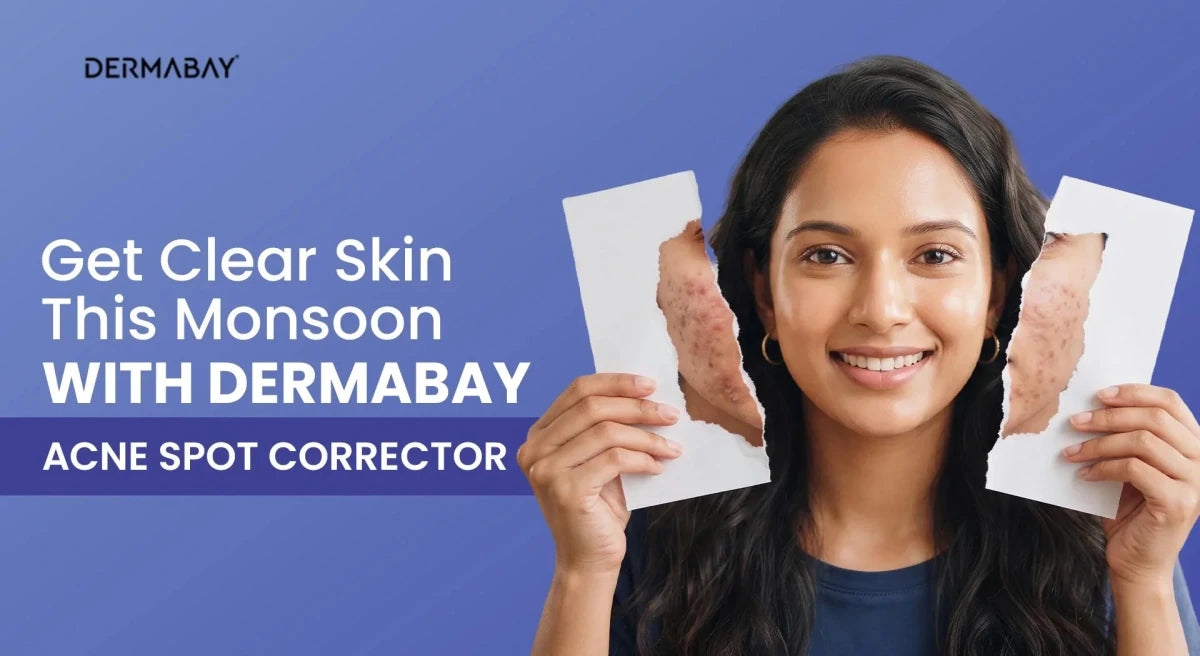 Get Clear Skin This Monsoon With Dermabay Acne Spot Corrector - Dermabay