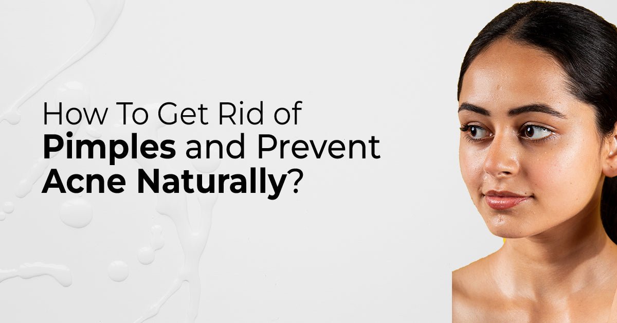 How To Get Rid of Pimples and Prevent Acne Naturally? - Dermabay