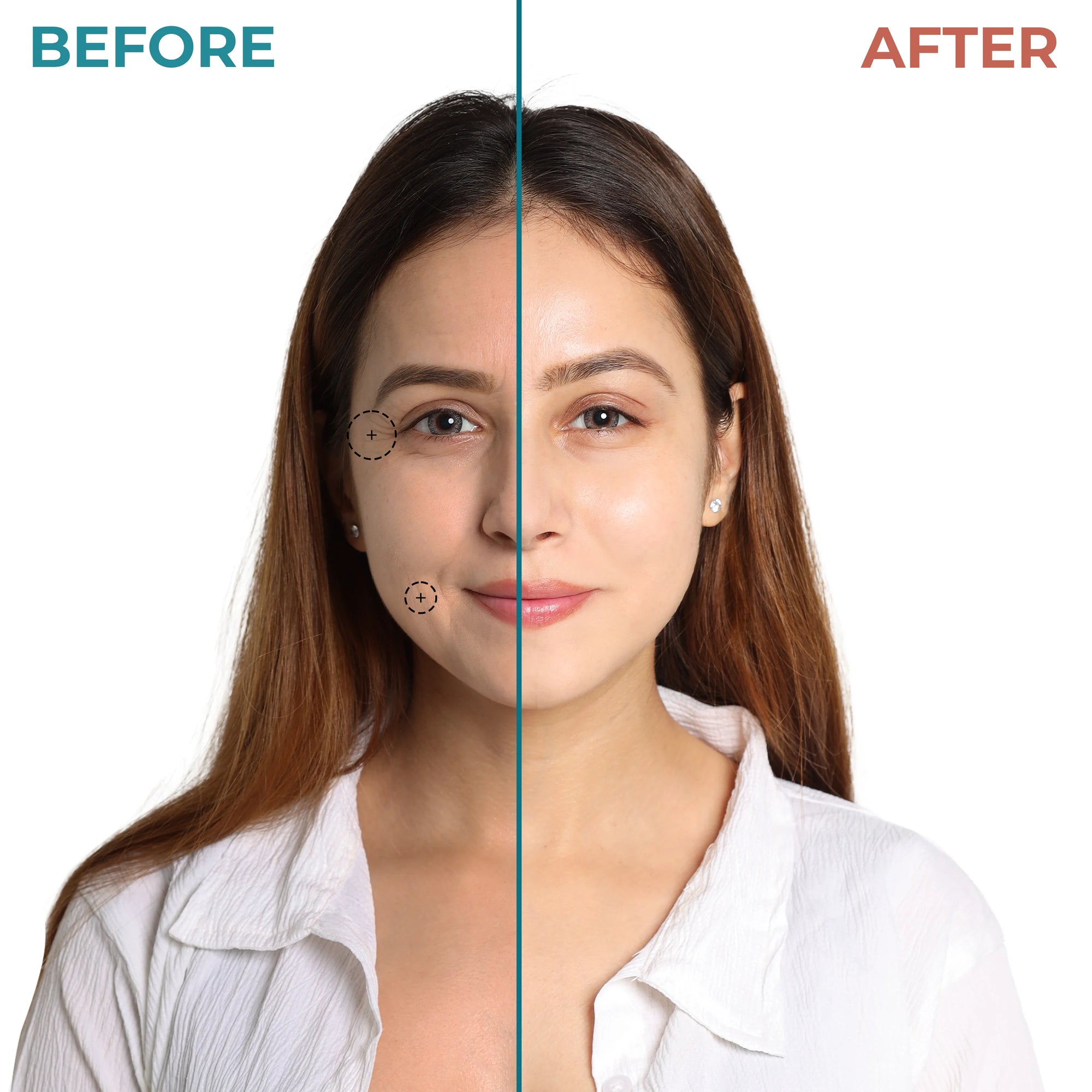 Night Skincare Kit Before and after