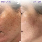 Anti Pigmentation ComboDermabay