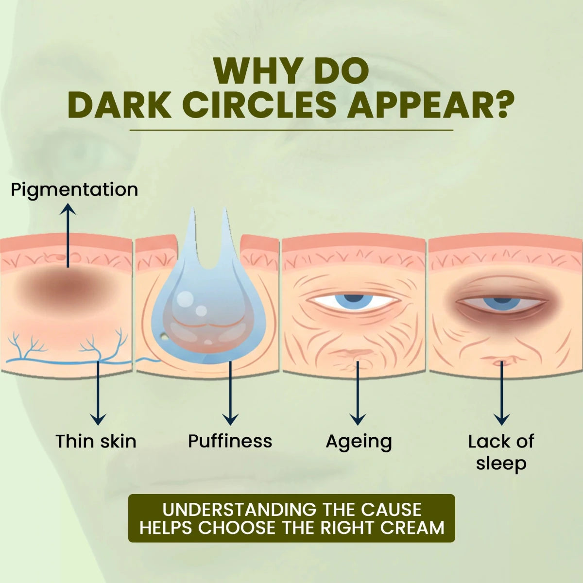 Cream to Get Rid of Dark CirclesUnder Eye CreamDermabay