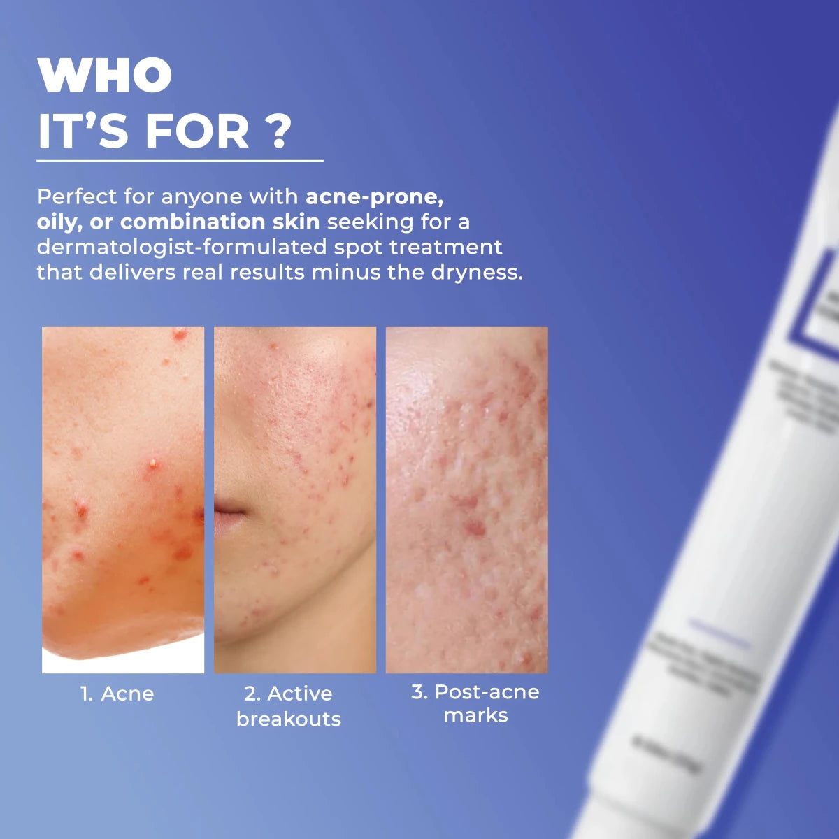 Dermabay Acne Spot CorrectorDermabay