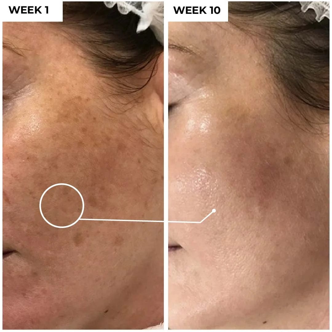 Kojic Acid Brightening SerumDermabay