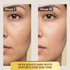 Serum with Alpha ArbutinDermabay