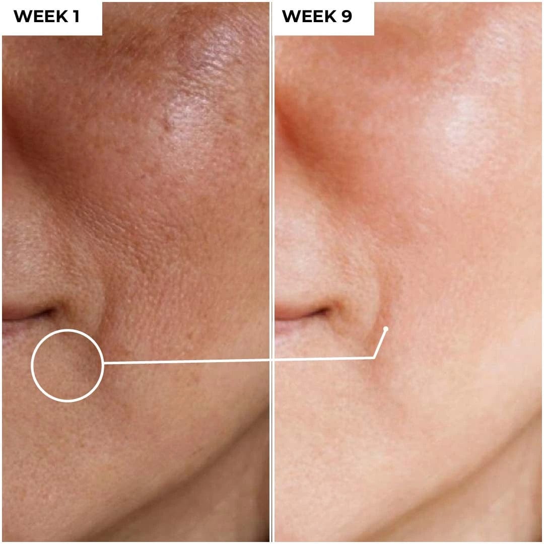 Vitamin C 15% + Hyaluronic Acid 1% SerumDermabay